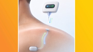 Permudah Pengisian Daya Medis, Peneliti UCI Kembangkan Perangkat Implan Bioelektronik